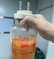 甘南水动力吸脂手术要做多久？